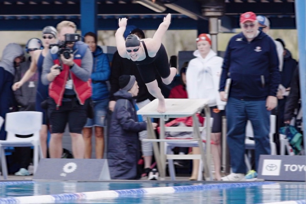 Swimmer Undergoes Experimental Amputation That Preserves Leg Muscles